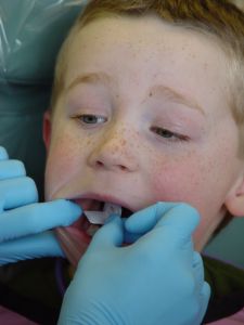 Finding dental care for kids with special needs can be difficult at best and impossible at worst as this post shows.