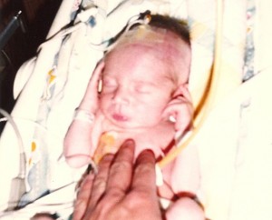 Thirty Years Ago Today in NICU