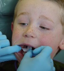 Dental Care for Kids with Special Needs