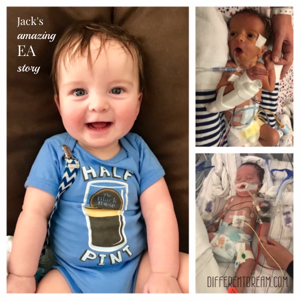 The Cheneys didn't expect their baby's life to be an esophageal atresia story. For EA/TEF Awareness Month, Jen tells the tale of their sons first 8 months.